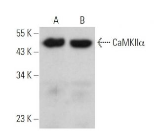 CAMK2A/CaMKII alpha Antibody (A-1) - Western Blotting - Image 362028 