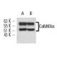 CAMK2A/CaMKII alpha Antibody (B-2) - Western Blotting - Image 13499