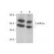 CAMK2A/CaMKII alpha Antibody (B-2) - Western Blotting - Image 352785 