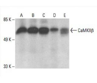 CaMKII beta Antibody (D-6) - Western Blotting - Image 392865 