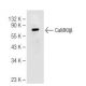 CaMKII beta Antibody (K-19) - Western Blotting - Image 82652 
