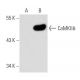 CaMKII delta Antibody (L-04) - Western Blotting - Image 31626 