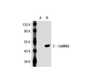 CaMKII delta (L-04): sc-100362. Western blot analysis of CaMKII delta expression in...
