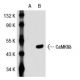 CaMKII delta (L-04): sc-100362. Western blot analysis of CaMKII delta expression in...