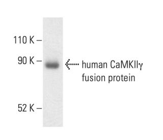 CaMKII gamma Antibody (8G10C1) - Western Blotting - Image 404246