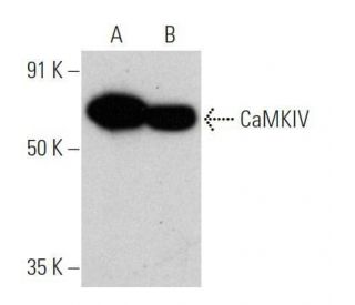 CaMKIV Antibody (C-7) - Western Blotting - Image 356184 
