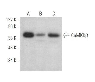 CaMKKβ Antibody (C-11) - Western Blotting - Image 375164