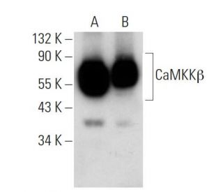 CaMKK&beta; Antibody (ZZ9) - Western Blotting - Image 74508Each CRISPR/Cas9 Knockout (KO) Plasmid product consists of a pool of 3 plasmids designed to ensure identification and cleavage of a specific gene for maximum knockout efficiency. Each plasmid encodes a unique 20 nt sequence derived from the GeCKO (v2) library. 