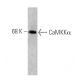 CaMKKα Antibody (6) - Western Blotting - Image 127468
