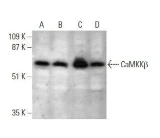 CaMKK&beta; Antibody (C-11) - Western Blotting - Image 386141 