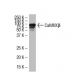 CaMKKβ Antibody (ZZ9) - Western Blotting - Image 33740