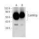 CaMKKβ Antibody (ZZ9) - Western Blotting - Image 74508 