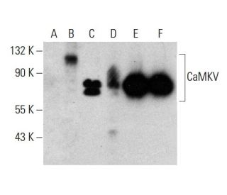 CaMKV Antibody (2F3-1A2) - Western Blotting - Image 376881 