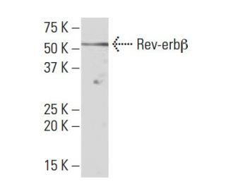 CAP2 Antibody (NN12) - Western Blotting - Image 34287 
