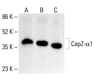 CapZ-α1 Antibody (2) - Western Blotting - Image 412788