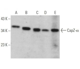 CapZ-&alpha; Antibody (C-1) - Western Blotting - Image 374649 