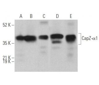 CapZ-&alpha;1 Antibody (2) - Western Blotting - Image 373203 