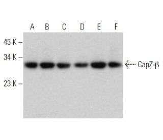 CapZ-&beta; Antibody (52) - Western Blotting - Image 371704 
