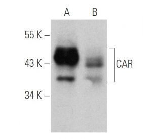 CAR Antibody (Mab.E[mh] 1) - Western Blotting - Image 354784 