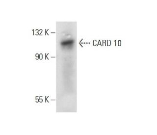 CARD 10 Antibody (B-4) - Western Blotting - Image 137652 