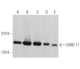 CARD 11 Antibody (A-4) - Western Blotting - Image 363778SAM Transcription Activation: SAM system utilizing dCas9-VP64, MS2-P65-HSF1, and sgRNA for precise gene transcription activation.