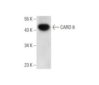 CARD 8 Antibody (2108C2a) - Western Blotting - Image 299143 