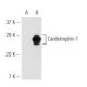 Cardiotrophin-1 Antibody (4916) - Western Blotting - Image 54562