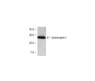 Cardiotrophin-1 Antibody (AN-B3) - Western Blotting - Image 2551 