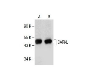 CARKL Antibody (H-5) - Western Blotting - Image 155311 