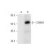 CARM1 Antibody (B-10) - Western Blotting - Image 309598