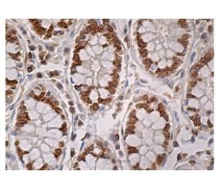 CARMIL Antibody (E-10) - Immunohistochemistry - Image 161028 