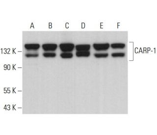 CARP-1 Antibody (E-4) - Western Blotting - Image 377687