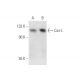 Cas-L Antibody (14A11) - Western Blotting - Image 56841 