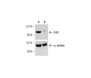 CAS siRNA (h): sc-29908. Western blot analysis of CAS expression in non-transfected control (A) and CAS siRNA transfected 