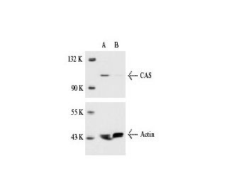 CAS siRNA (m): sc-29909. Western blot analysis of CAS expression in non-transfected control (A) and CAS siRNA transfected 