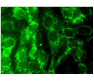 casein kinase I&epsilon; Antibody (A-2) - Immunofluorescence - Image 297231 