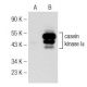 casein kinase Iε Antibody (A-6) - Western Blotting - Image 148715