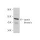 casein kinase Iε Antibody (A-6) - Western Blotting - Image 355261 