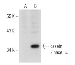 casein kinase I&alpha; Antibody (D-9) - Western Blotting - Image 30480