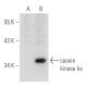 casein kinase Iα Antibody (D-9) - Western Blotting - Image 30480