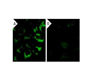 casein kinase I&alpha; siRNA (h): sc-29912. Immunofluorescence staining of methanol-fixed, control HeLa (A) and casein kin