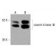 酪蛋白激酶Iδ抗体(C-4):sc-514942。HeLa(A)和HCT-116(B)全细胞裂解液中酪蛋白激酶Iδ表达的Western blot分析。检测试剂:m-IgG3 BP-HRP:sc-533670。 casein kinase Iδ Antibody (C-4) - Western Blotting - Image 415727