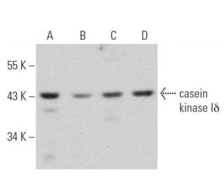casein kinase I&delta; Antibody (C-8) - Western Blotting - Image 355293 