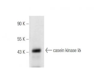 casein kinase I&delta; Antibody (E-10) - Western Blotting - Image 14531 