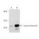 casein kinase Iδ Antibody (E-10) - Western Blotting - Image 41620