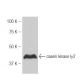 casein kinase Iγ2 Antibody (26-P) - Western Blotting - Image 53851