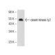 casein kinase Iγ2 Antibody (26-P) - Western Blotting - Image 72714 