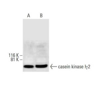 casein kinase I&gamma;2 Antibody (F-10) - Western Blotting - Image 291837