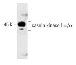 casein kinase II&alpha;/&alpha;&prime; Antibody (31) - Western Blotting - Image 127483