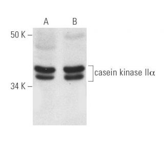 casein kinase II&alpha; Antibody (1AD9) - Western Blotting - Image 2191 